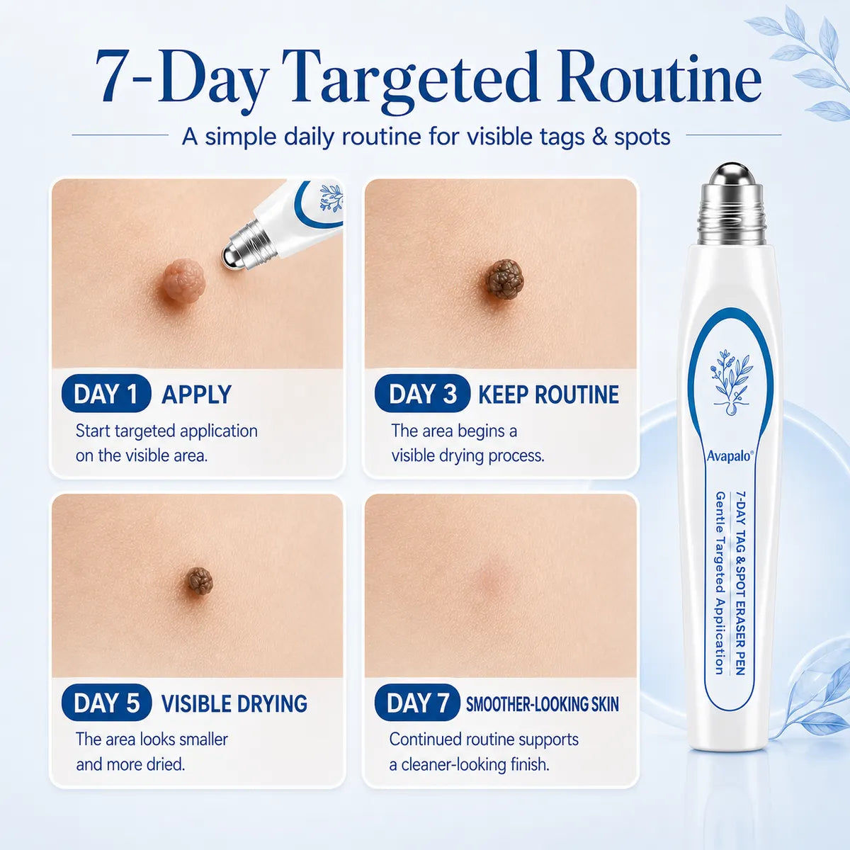 🆙𝟕-𝐃𝒂𝘆 𝐒𝗸𝐢𝐧 𝐓𝒂𝗴 & 𝐒𝐩𝙤𝐭 𝐄𝐫𝒂𝐬𝙚𝐫 Painless & Scar-Free Advanced Imperfection Removal Rollerball Pen