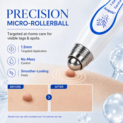 𝟕-𝐃𝒂𝘆 𝐒𝗸𝐢𝐧 𝐓𝒂𝗴 & 𝐒𝐩𝙤𝐭 𝐄𝐫𝒂𝐬𝙚𝐫 Painless & Scar-Free Advanced Imperfection Removal Rollerball Pen