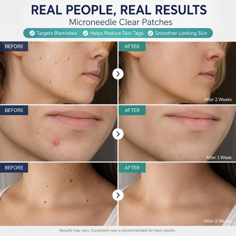✨Effective MicroNeedle BotanicSkinTag Removal Patch