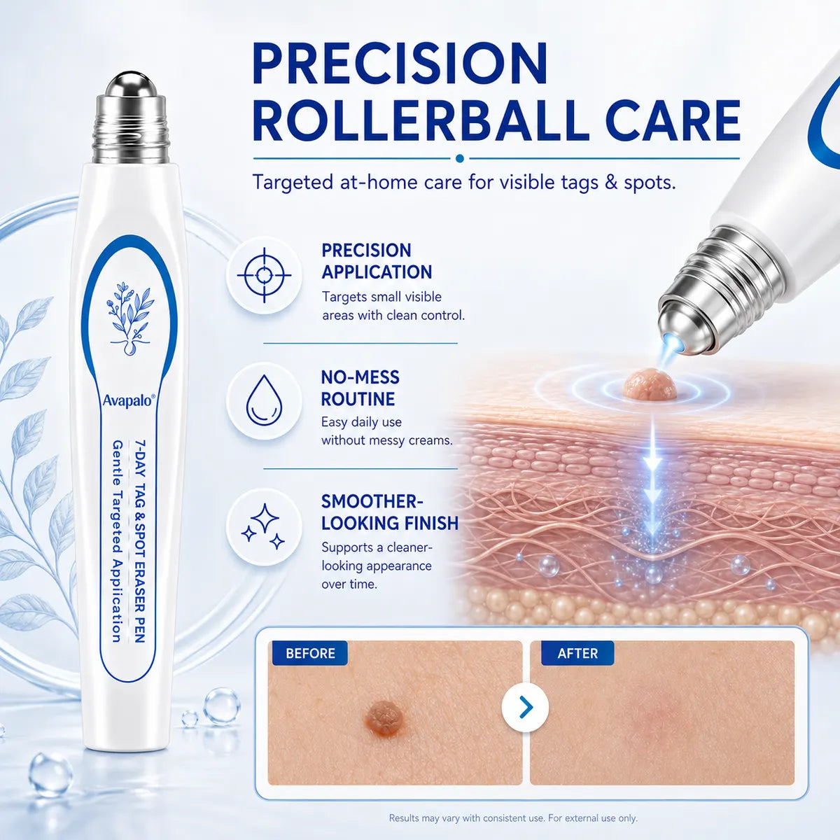 🆙𝟕-𝐃𝒂𝘆 𝐒𝗸𝐢𝐧 𝐓𝒂𝗴 & 𝐒𝐩𝙤𝐭 𝐄𝐫𝒂𝐬𝙚𝐫 Painless & Scar-Free Advanced Imperfection Removal Rollerball Pen