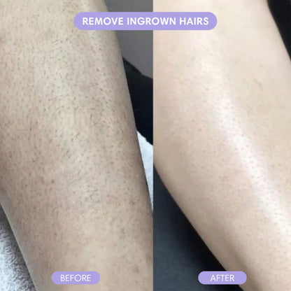 💖✨2-in-1 Painless Bikini Hair Trimmer for Face & Body