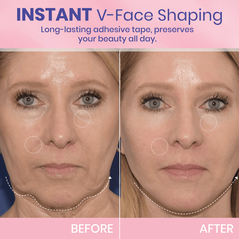 ✨ V-Face Lifting Tape – Instant Jawline Lift & Slim Look