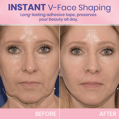 ✨ V-Face Lifting Tape – Instant Jawline Lift & Slim Look