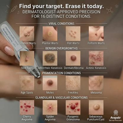 🆙𝟕-𝐃𝒂𝘆 𝐒𝗸𝐢𝐧 𝐓𝒂𝗴 & 𝐒𝐩𝙤𝐭 𝐄𝐫𝒂𝐬𝙚𝐫 Painless & Scar-Free Advanced Imperfection Removal Rollerball Pen